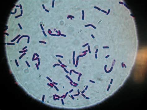 Bacillus Cereus Morphology And Arrangement