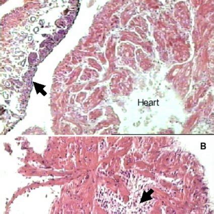 Interaction of Schistosoma mansoni sporocyst and hemocytes from ...