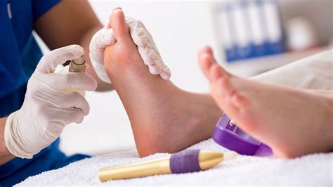 Podiatry Specialist in Brooklyn | IDCC Health Services