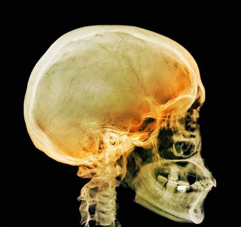 Human Skull Profile Stock Pictures, Royalty-free Photos & Images ...