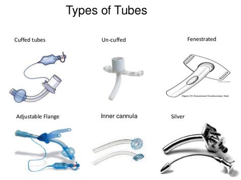 tracheostomy