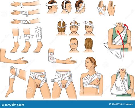 Bandaging techniques stock vector. Illustration of ankle - 47632598