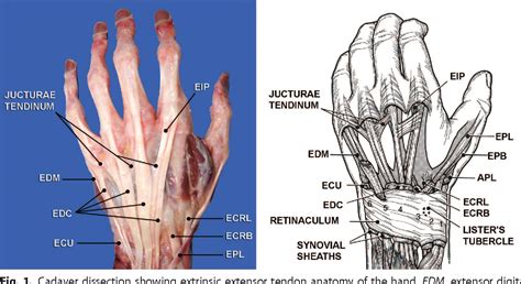 Hand Tendon Anatomy - Anatomical Charts & Posters