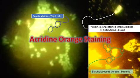 Acridine Orange Staining: Introduction, Principle, Procedure, Result Interp