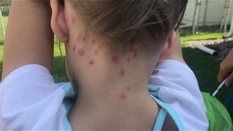 Twin Cities swarming with bumper crop of gnats | kare11.com