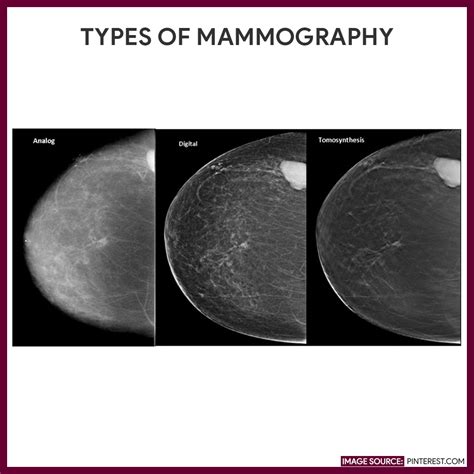 Mammography (Mammogram) - Nursing Responsibilities - Nurseslabs