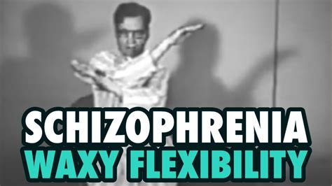 Schizophrenia and Waxy Flexibility - YouTube