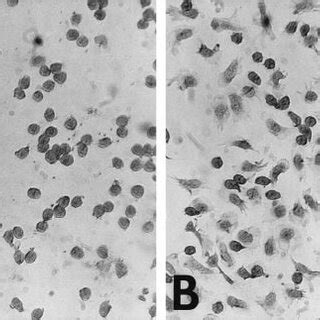 Polarization of neutrophils on wells coated with factor H. Neutrophils ...