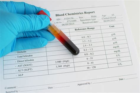 High/Low Aspartate Aminotransferase Levels + Function & Diseases ...