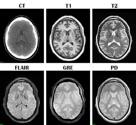 Pin oleh Jenny Duscio di Upgrading to MRI di 2024 | Radiologi