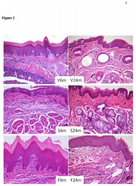 Keratinized Gingiva Histology