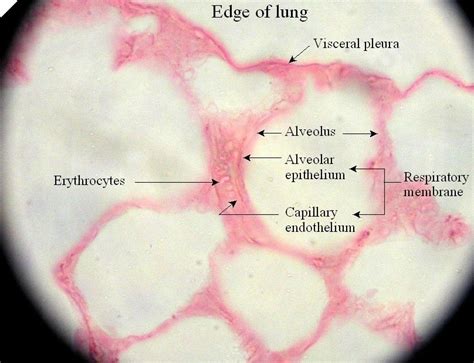 alveoli histology labeled - Google Search | Histología/Histology ...