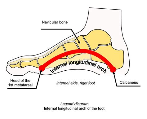 Pathologies > Sagging arch of the foot