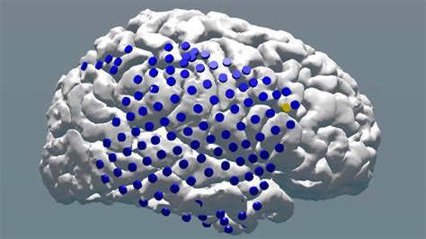 New Research Shows Electric Brain Stimulation Can Help Memory