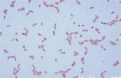 Solved could this Gram stain be Gram negative bacili of | Chegg.com