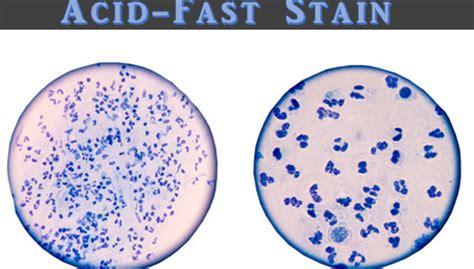 Acid-fast staining or Ziehl-Neelsen staining : Principle, Requirements ...