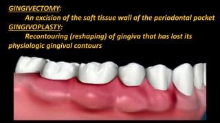 Gingivectomy and Gingivoplasty | PPT