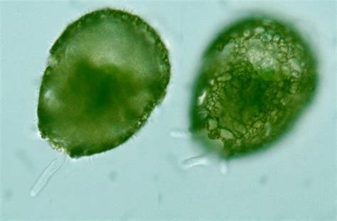 Protist Images: Difflugia