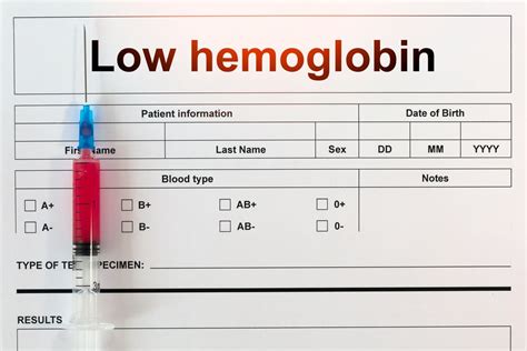 Ten Reasons Your Hemoglobin Might Be Low - Facty Health