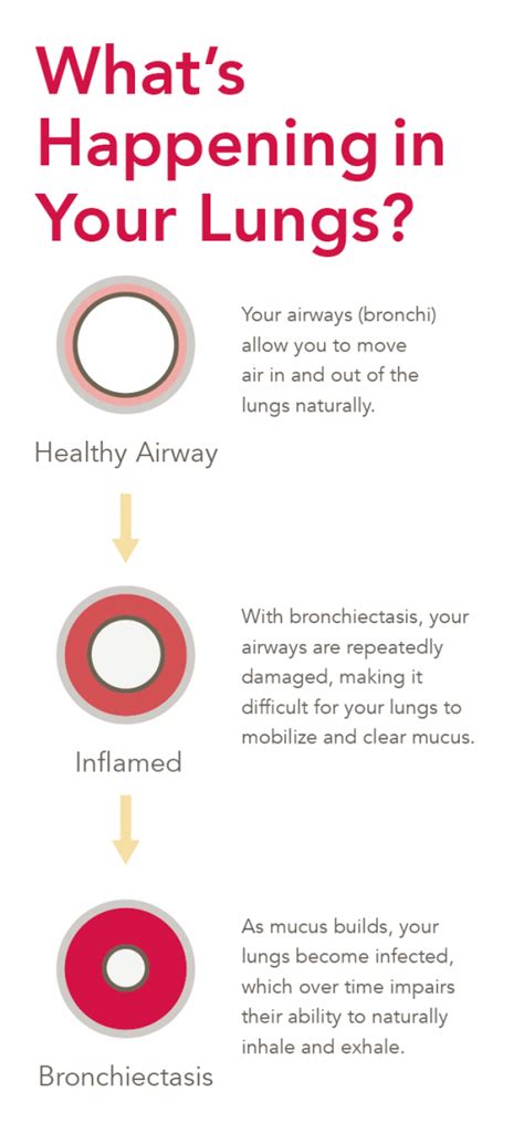 Congested Lungs: Causes, Symptoms, and Treatment | SmartVest