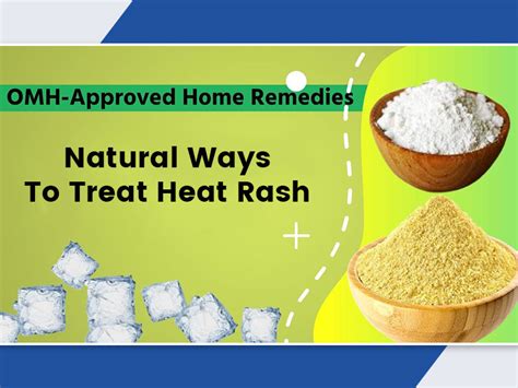 OMH-Approved Home Remedies To Treat Heat Rash or Prickly Heat