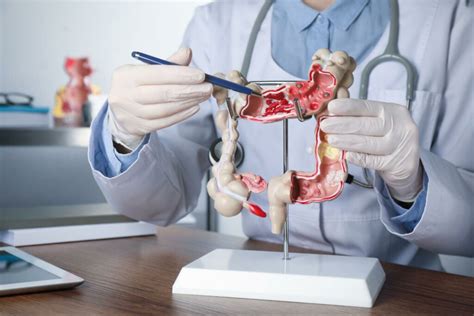 What to Consider When Selecting a Gastroenterologist - Birmingham ...