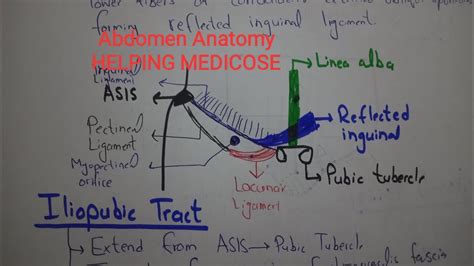 Inguinal ligament and Iliopubic tract - YouTube