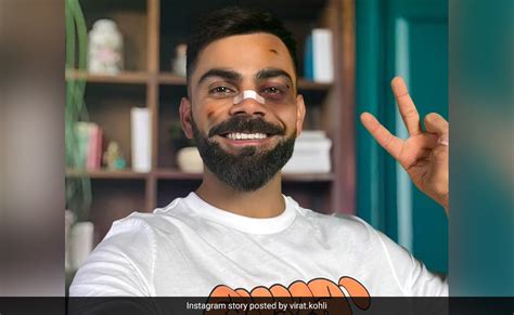 "Should See The Other...": Virat Kohli 'Beaten Up' Instagram Story ...