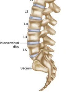 L5 S1 Fusion Surgery: Success Rate & Complications - CSC