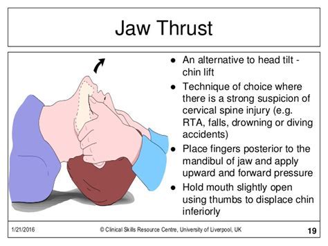 jaw-thrust.jpg - Nursing - Notes - Teachmint