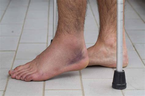 Ankle Sprain Exercises: Tips to a Faster Recovery! | PT Time with Tim