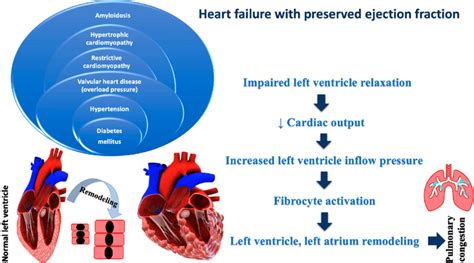 Pathophysiology of heart failure with preserved ejection fraction ...