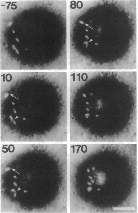 Anaphase chromosome movement in a monopolar spindle, shown by ...