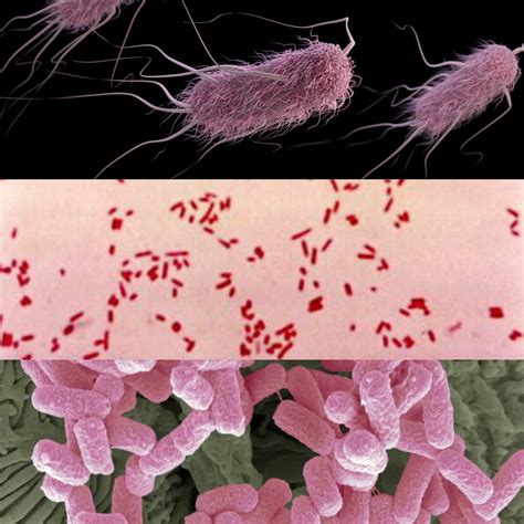 Escherichia coli - jcarrbiomed.com : 365 Days of Microscopy