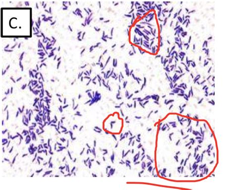 Corynebacterium Gram Stain