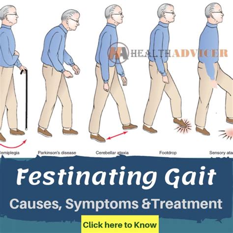 Festinating Gait: Causes, Picture, Symptoms And Treatment