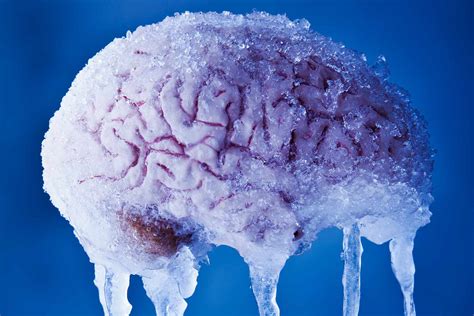 What Causes Brain Freeze and Ice Cream Headaches?