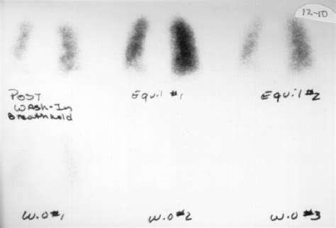 Figure 12-7 from PREVENTION OF IMMOBILITY COMPLICATIONS THROUGH EARLY ...