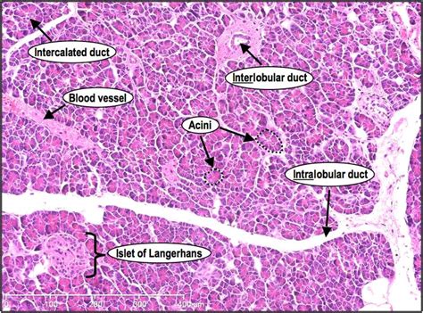 exocrine pancreas - Google Search | Histology slides, Pancreas, Medical ...