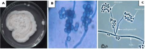 Macroscopic (A) and microscopic (B) characters of isolated Beauveria ...