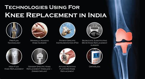 Knee Replacement Surgery In Hyderabad | India - Landmark Hospitals