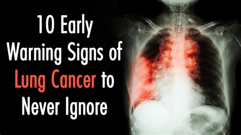 10 Early Warning Signs of Lung Cancer to Never Ignore