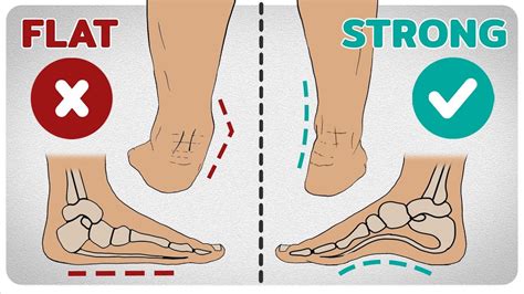 The Arches Of The Foot Longitudinal Transverse TeachMeAnatomy | 6b.u5ch.com