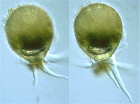 Protist Images: Difflugia