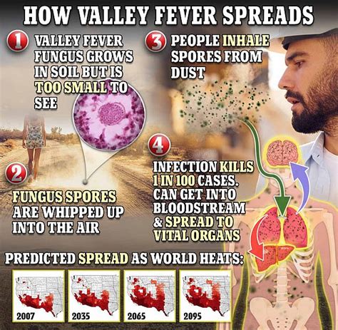 Claim: Deadly fungal infection ‘Valley Fever’ is spreading across USA ...