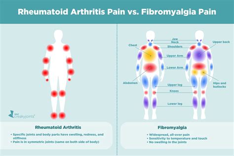 Causes of Rheumatoid Arthritis Pain Aside from Inflammation