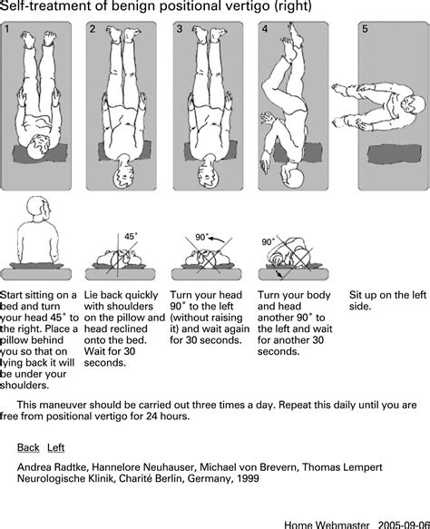 Diagram Of Epley Maneuver