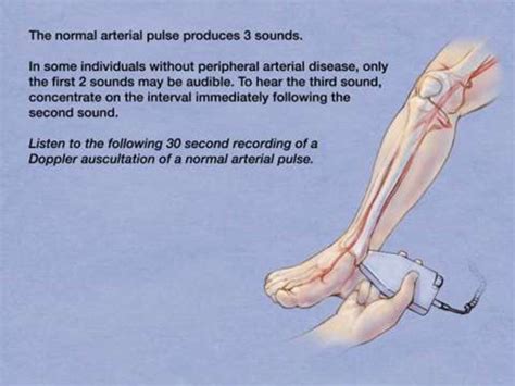 Posterior Tibialis Pulse