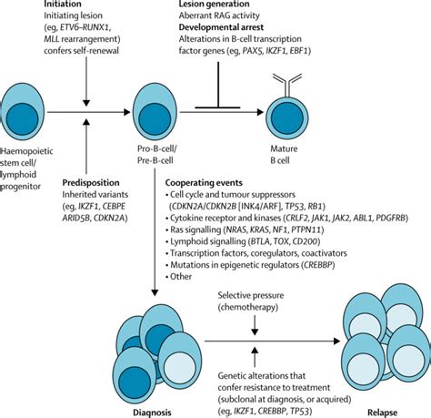 Acute lymphoblastic leukaemia - The Lancet