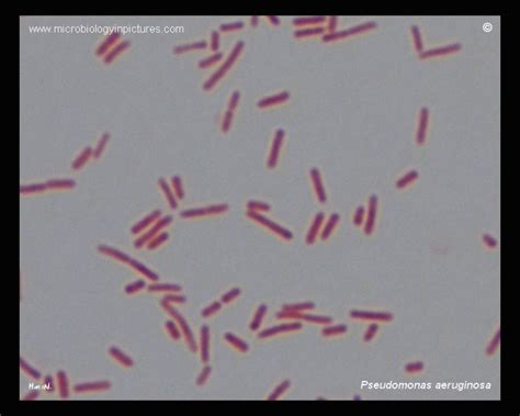 Pseudomonas aeruginosa under microscope. Gram-stained culture of ...